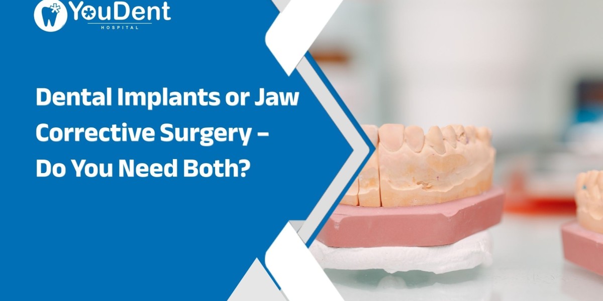Dental Implants or Jaw Corrective Surgery – Do You Need Both?