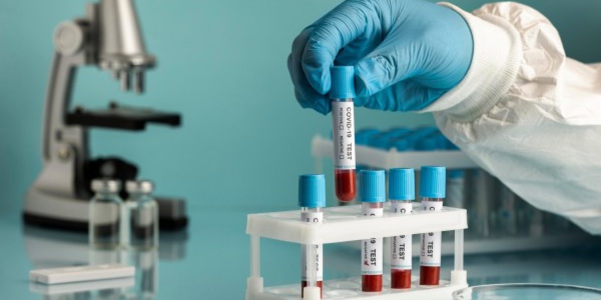 Private Blood Test in London – Fast, Accurate, and Convenient