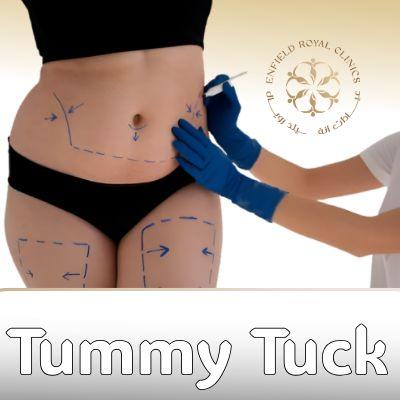 Best Tummy tuck surgery in Islamabad | Enfield Royal Clinic