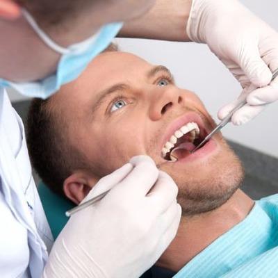 Root Canal Treatment Cost in Islamabad