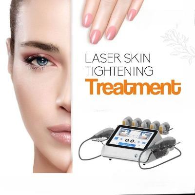 Laser Skin Tightening in Islamabad, Rawalpindi- ERCs