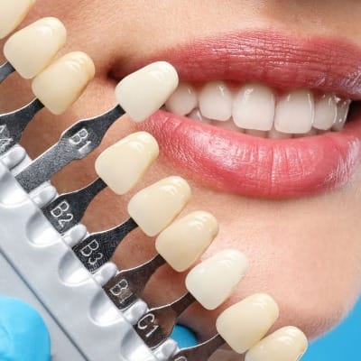 Dental Implants Clinic in Islamabad F7